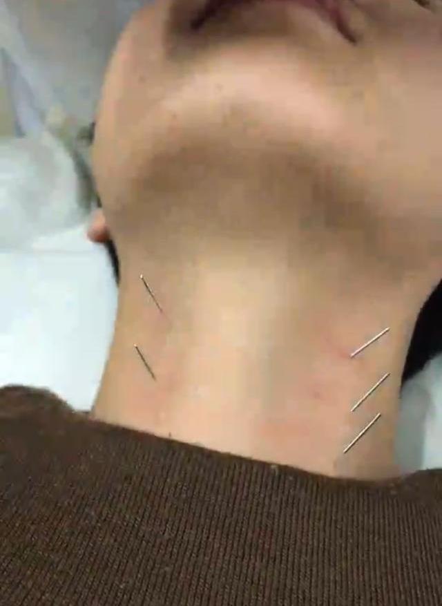 甲状腺最新治疗方法的论述与探讨